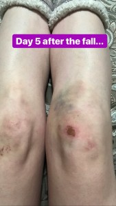 929A7507-8B7D-4D75-94AC-880269D9B723